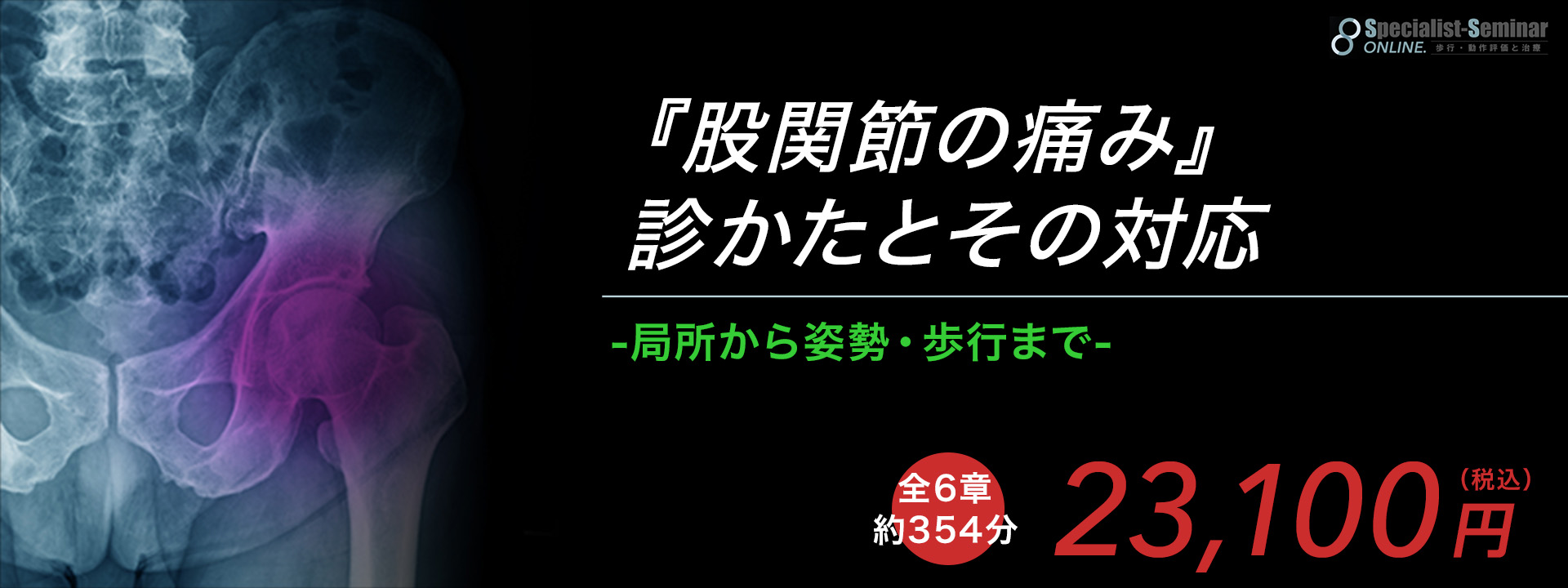 『股関節の痛み』診かたとその対応